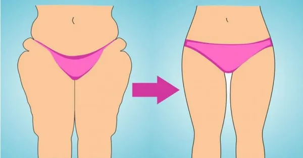 Просвет между бедрами у женщин: как добиться промежутка и похудеть в ногах. 2