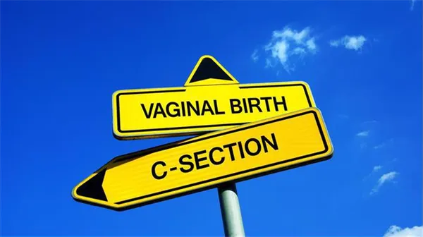Допустима ли беременность после кесарева сечения. 15