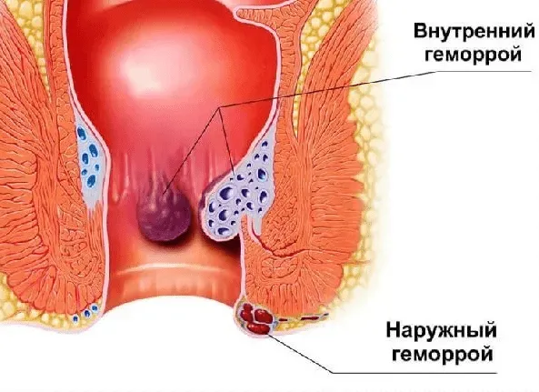 Что делать если не успел вытащить Не успел 7