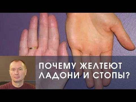 ПОЧЕМУ ЖЕЛТЕЮТ ЛАДОНИ И СТОПЫ?