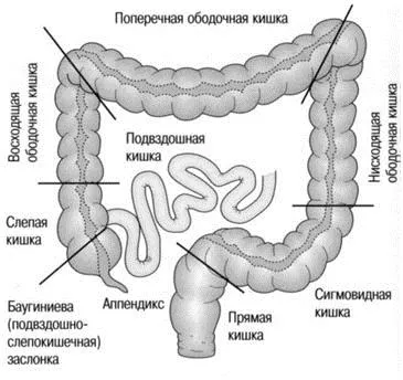 Язвенный колит