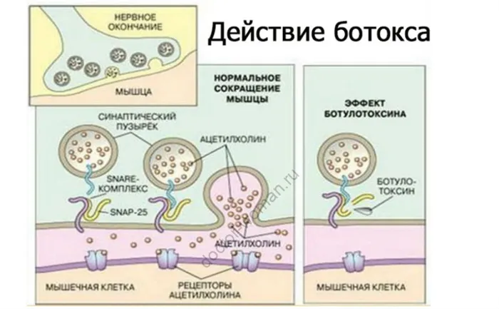 Действие ботокса