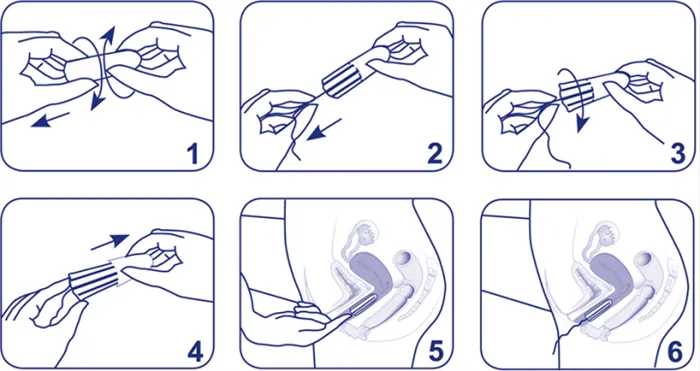 Вот как вставляется тампон