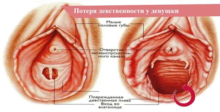 Потеря девственности у девушки