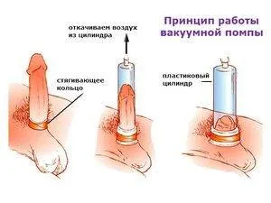 Принцип работы вакуумной помпы для увеличения члена